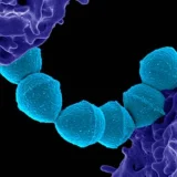 Япон: Ховор боловч аюултай бактерийн халдварын хүндрэлд санаа зовох хэрэггүй